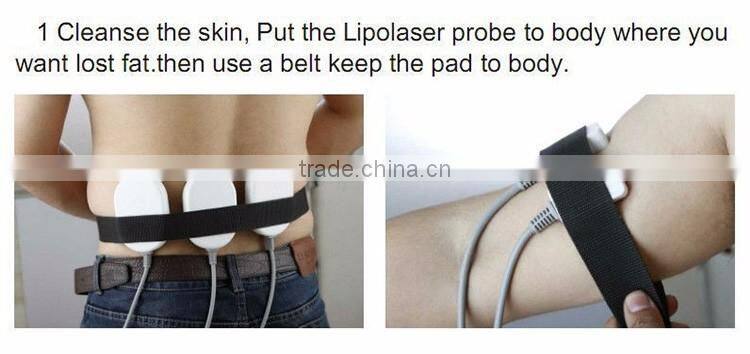 CE approval home use laser fat removal beauty equipment