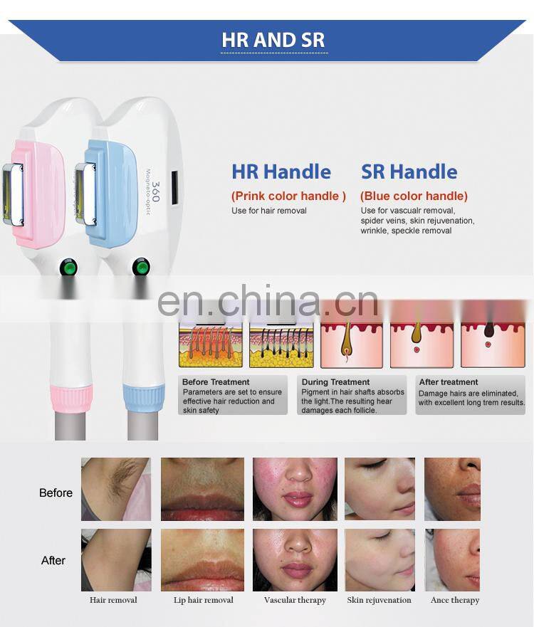 4 in 1 e-light ipl rf skincare shr epilator equipment with q switch nd yag laser tattoo removal system