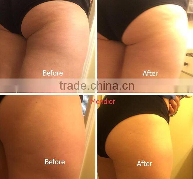 Mendior Container Coconut Milk Body Scrub Exfoliates, Moisturizes OEM custom brand