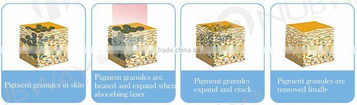 Hottest factory price!! laser tattoo removal q switched keyword:nd yag laser