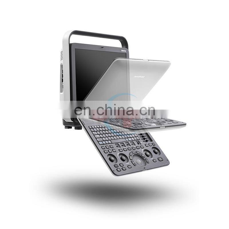 Professional 4D Color Doppler Sonoscape ultrasound scanner/Portable Sonoscape S8 EXP/Sonoscape ultrasound