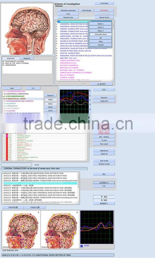 Quantum Health Analyzer Auto Full Body Health Analyzer Nonlinear Analysis Systems 9D Nls Health Analyzer