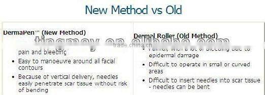 192 pins zgts titanium derma roller for home use tm-086