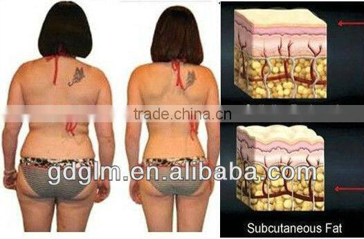 Factory Direct price two vacuum roller rf infared light machine