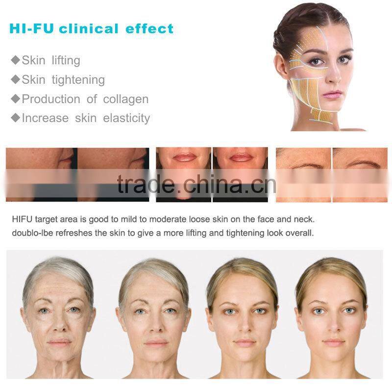 photon ultrasonic beauty machine