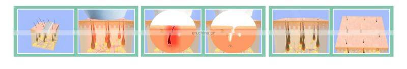 DEESS Xmas gift automatic flashing can support  family permanent hair removal photo facial machine