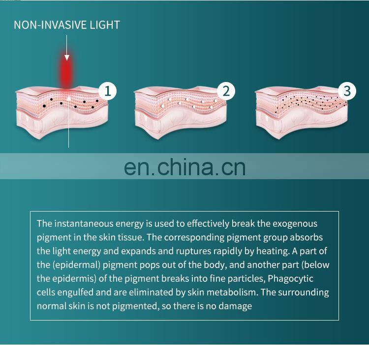 Non Invasive Tattoo Removal Laser Instrument Double Head Q Switch ND Yag Laser Machine Eyebrow Pigment Removal Beauty Instrument