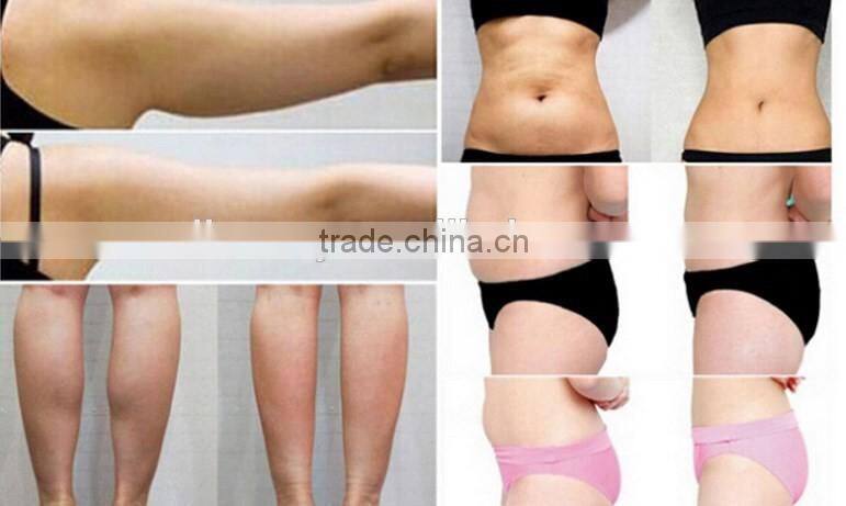 2016 New technology hifu slimming machine / lipo hifu machine