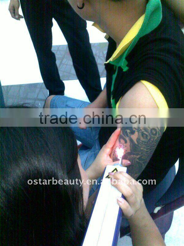 (2013 Hot sales) MINI pigment removal tattoo removal laser machine OB-TR 03