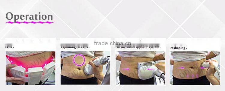 4 in 1 tripolar rf slimming equipment using ultrasound gel OD-S10