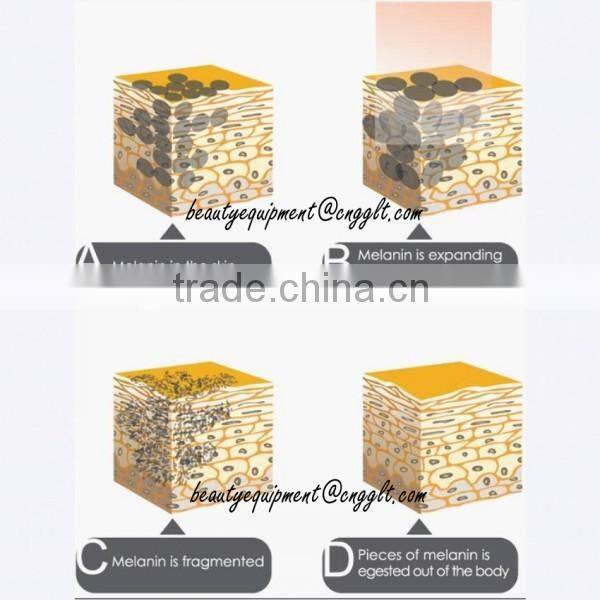 Factory price tattoo removal costs for black , red, brown,colorful tattoo