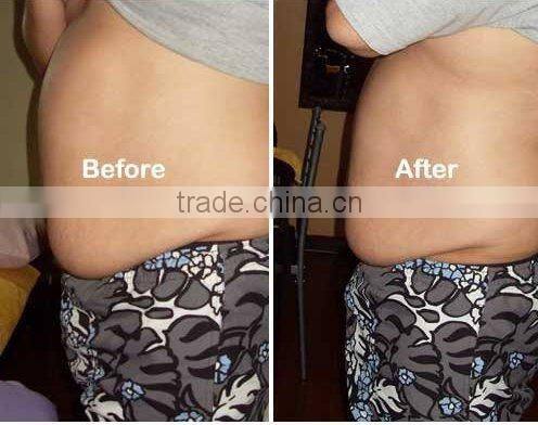 2011 Professional Ultrasonic rf liposuction slimming equipment to repel cellulite and tighten flabby skin