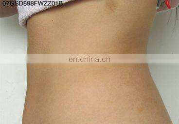 Professional GSD Vibration New Technology Roller Suction RF Face Laser Beauty Vacuum Cool HIFU Body Slimming Machine Omnislim