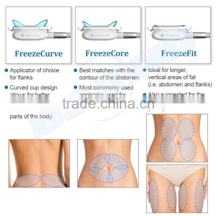 Criolipolise slimming / Criolipolisis slimming machine / Criolipolisys fat freezing cryolipolysis