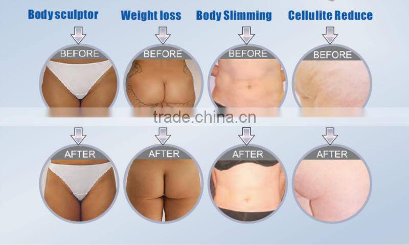 RF Vacuum Roller Warm Massage Skin Tightening With Lipocavitation For Body Shaping