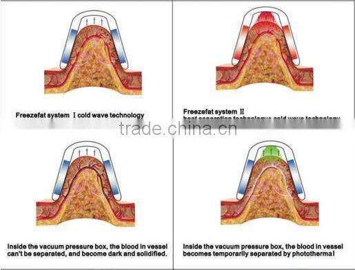 kim 8 new cavitation rf vacuum slimming machine