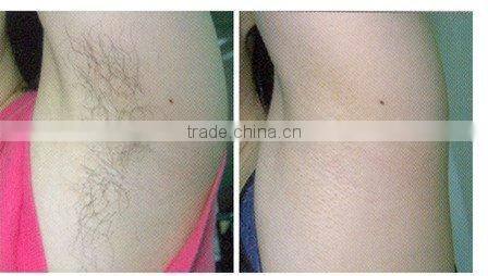 C001 elight portable hair removal machine