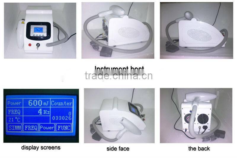 laser tattoo removal machine with competitive price