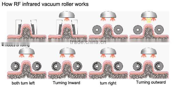 wrinkle removal Beauty weight loss radiofrequency equipment
