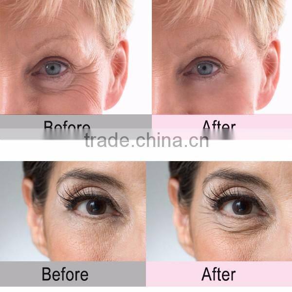 EYCO multifunction beauty device radio frequency machine for skin tightening radio frequency facial treatment rf facial machine