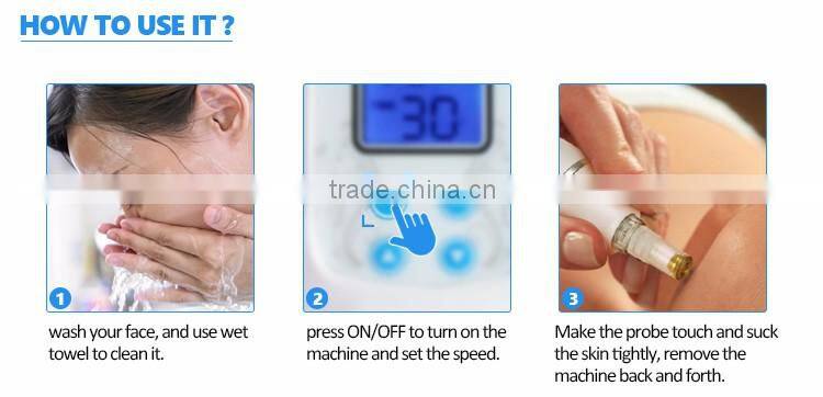 new diamond dermabrasion and vacuum machine