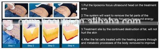 2016 Lipohifu ultrasonic liposuction body slimming machine - JT-Slim1