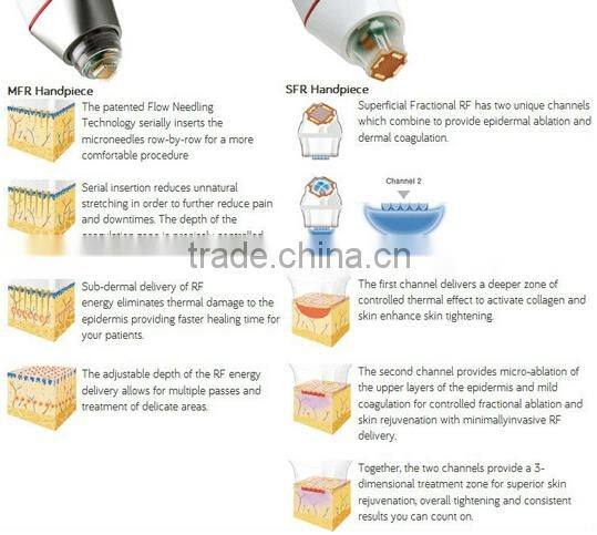 skin treatment 5mhz radio frequenc micro cell fraction rf skin lifting machine