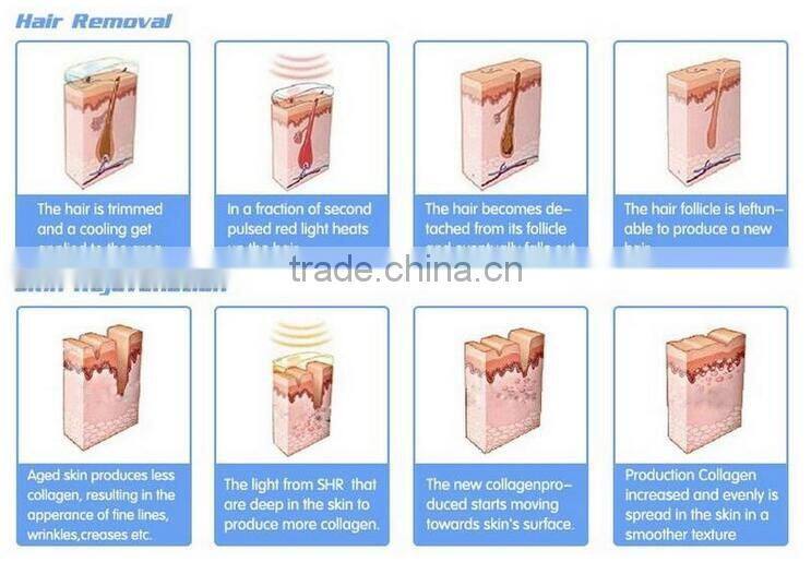 Best choice for beauty salon device White SHR(super hair removal) and IPL beauty handle