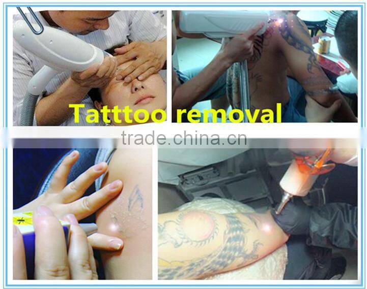q-switched nd:yag laser tattoo removal 2000mj