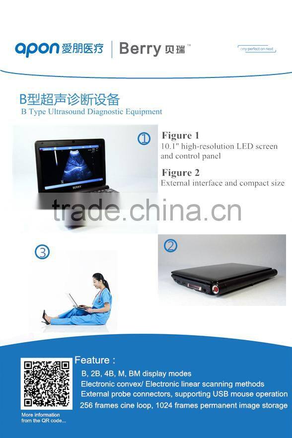 low price Portable Ultrasound machine, mini laptop Ultrasound Scanner