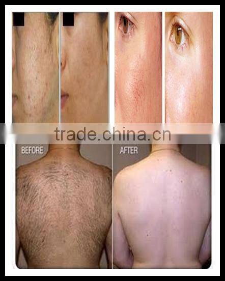 220v and 110v beauty system new shr ipl equipment for distributor med-240