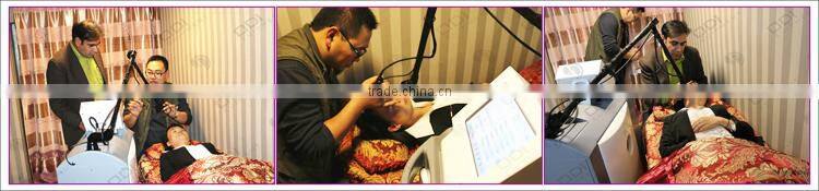 World best selling fractional co2 stretchmark and scar removal laser machine