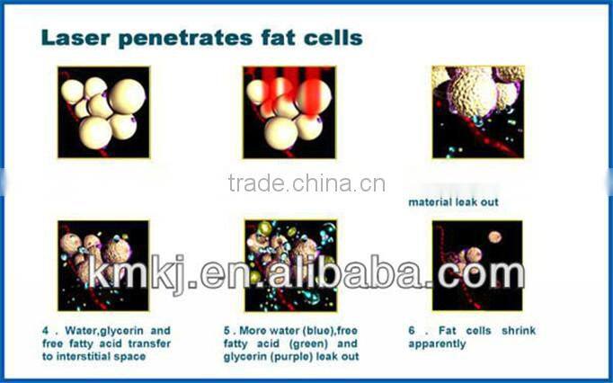 Factory price slimming laser