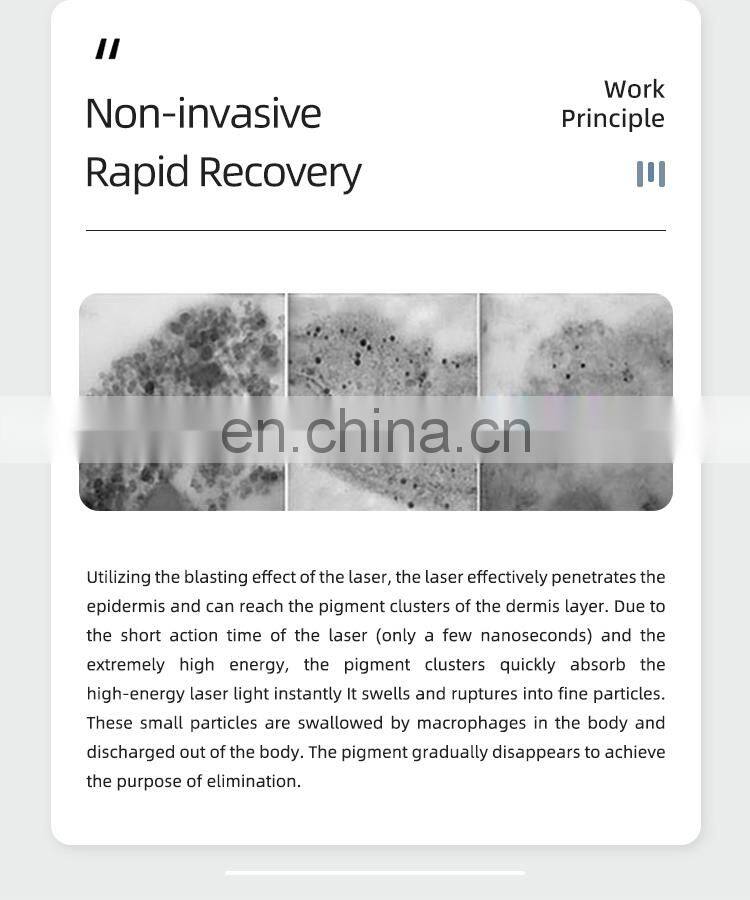 3 in 1 OPT Elight RF Nd Yag Laser Permanent Laser Tattoo Removal and Wrinkle Removal Machine