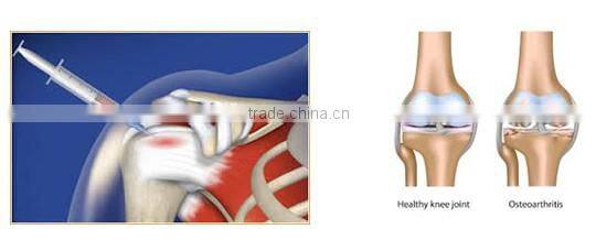 Patent PRP tube in China