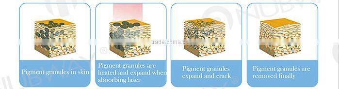 High frequency tattoo removal machines for sale