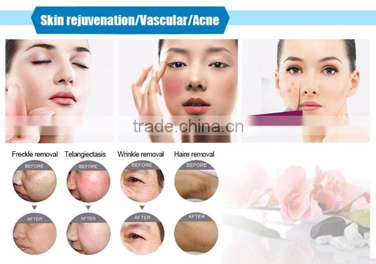 2017 New portable e-light ipl rf beauty machine ipl handpiecefor hair removal