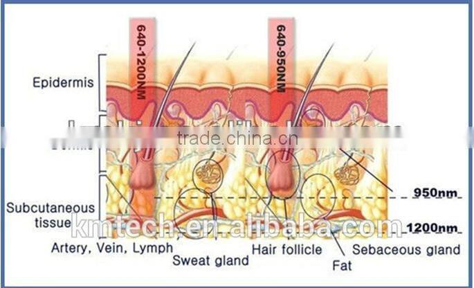 IPL e light equipment from china for the small business