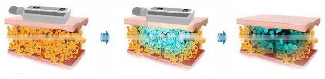 Multi-functional 360 cryo plates Fat Freezing Cellulite Removal Slimming Machine with 8 Pcs Cryo Pads