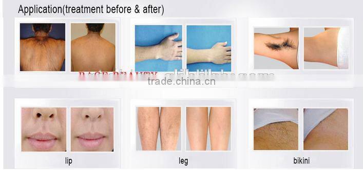 Double handles professional laser hair removal machinewith CE approved