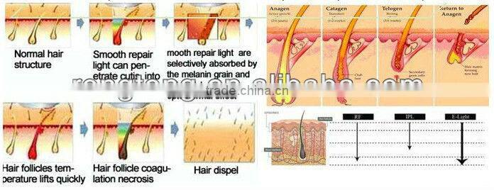 portable hair removal skin rejunvenation professional and intelligent machine med-160c