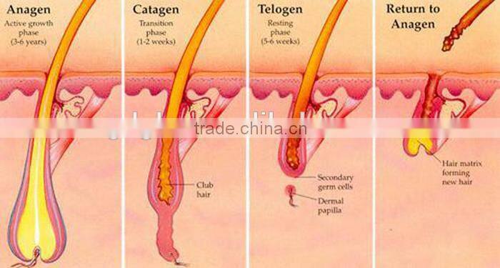 E-001 IPL hair removal machine/ IPL Machine