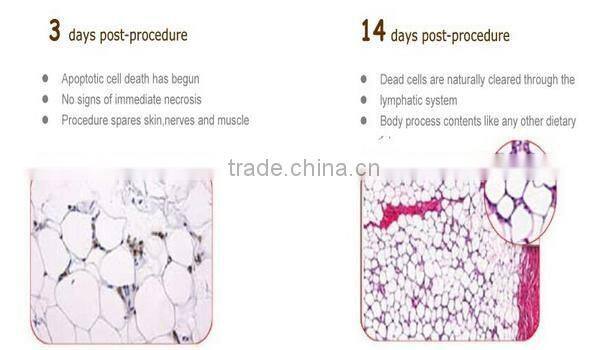 CE Certificated cryotherapy equipment Cavitation & RF & lipo laser Cryolipolysis lipo machine with teaching video