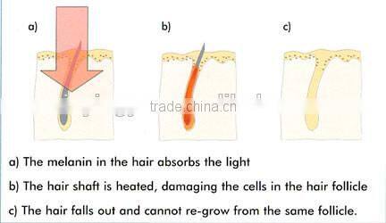 Portable Skin care SHR elight ipl hair removal machine
