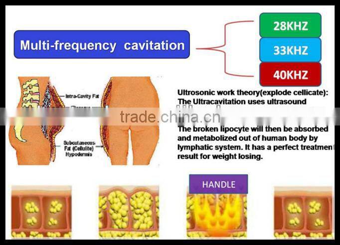 Portable and favorable ultrasound cavitation machine