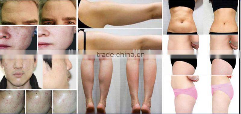 fast cavitation slimming system cavitation machine on big sale and manufacturing price