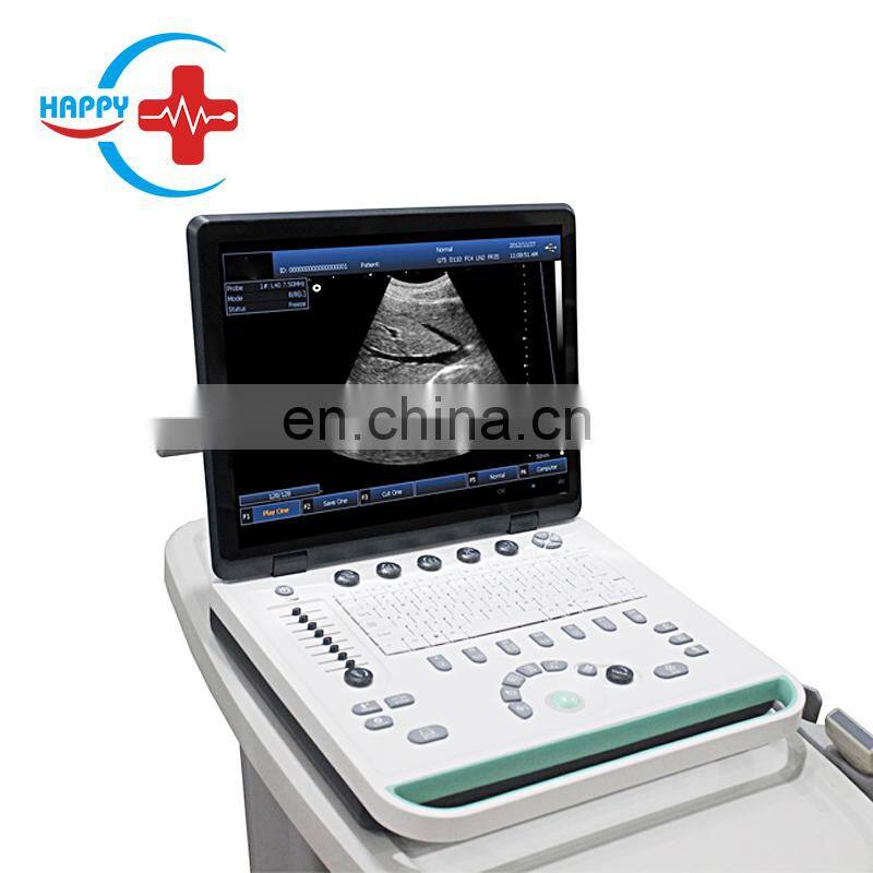 HC-A006B Full digital 15 inch Laptop Ultrasound machine with competitive price(ARM based)