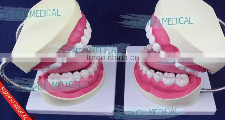 Teeth care model