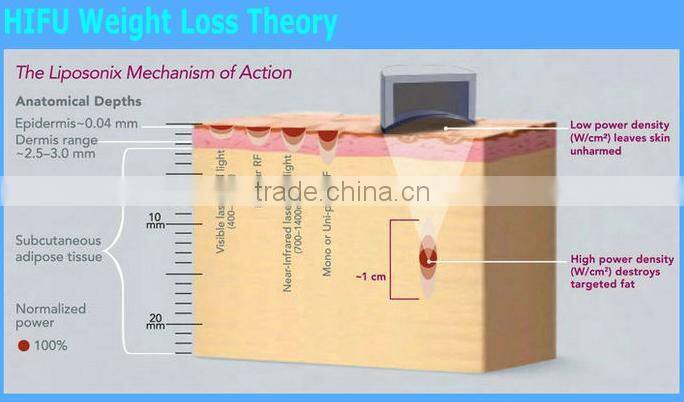 Same Tech As Ultrashape Best Price Real Hifu Slim Machine