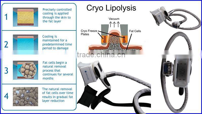 Distributors Opportunity / Frozen Lipo Cooling Fat / Remove Abdomen Slim Cryotherapy-Machine